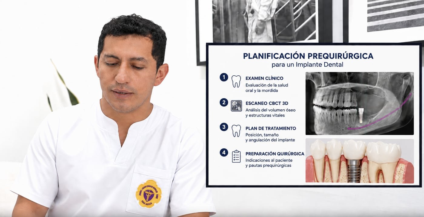 Planificación prequirúrgica para un implante dental